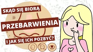 Rozjaśnianie przebarwień i blizn po trądziku  porady i kosmetyki [upl. by Resneps]