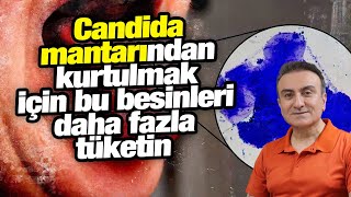 Candida mantarı ile savaşan besinler Candida diyeti [upl. by Oinigih190]