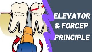 Principles of Elevator Forcep in Uncomplicated Exodontia Lever Wedge Wheel amp Axle Apexo Cryer [upl. by Aizitel]