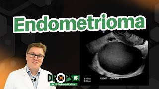 COMO RECONHECER O ENDOMETRIOMA NO ULTRASSOM I VOCÊ RADIOLOGISTA [upl. by Semela37]