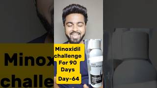 Minoxidil challenge For 90 daysDay64 [upl. by Attesoj159]