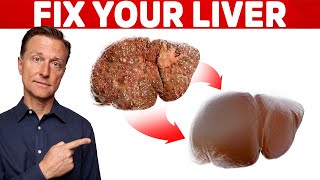 The 6 Best Ways to Heal a Fatty Liver [upl. by Darius]