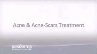 Mediderma Acne amp Acne Scar Treatment On ClickOnCare [upl. by Norabal]