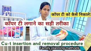 Insertion and Removal of CuT procedure Family planning methods Demonstration Nursing practical [upl. by Lean]