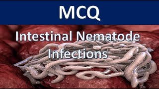 MCQ  Intestinal Nematode Infections with answers [upl. by Hareemas952]