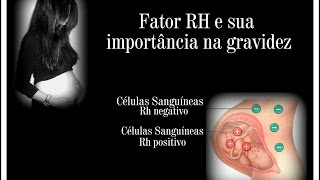 A Importância do Fator RH na Gravidez [upl. by Vachil]