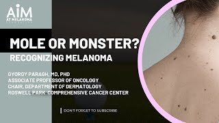 Mole or Monster Recognizing Melanoma [upl. by Ettenan]