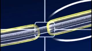 A SaltatoryConduction [upl. by Leban]