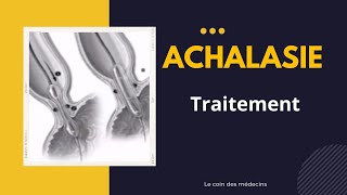 Achalasie [upl. by Lucien]