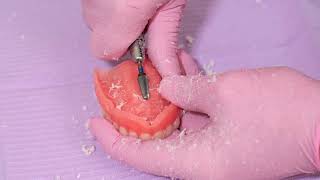 SOFRELINER TOUGH® Tips amp Tricks – Preparing the Denture Surface [upl. by Shanna]