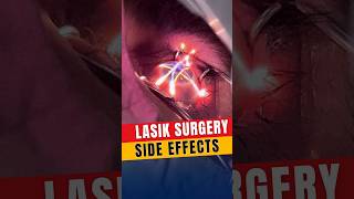 Side Effects Of Lasik Surgery [upl. by Philbrook]