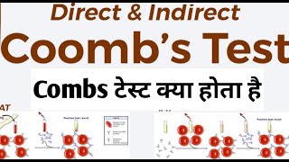 Direct coombs test [upl. by Pinter]