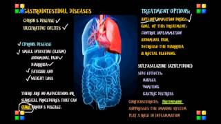 NCLEX Review on the Gastro Diseases Chrons Ulcerative [upl. by Schou950]