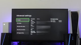 Cant Get Teredo Ip Address Xbox Series XS Fix [upl. by Gianni]