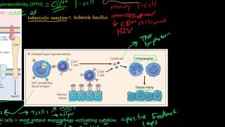 81P DelayedType Hypersensitivity TCellMediated Type IV Hypersensitivity [upl. by Ontine]