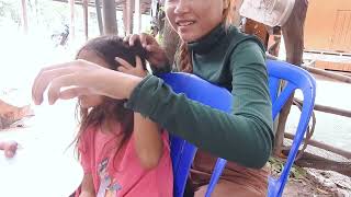 Get Rid of Lice FAST with This Simple Hack 2 [upl. by Lirva]