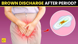 How To Stop Brown Discharge After Period  Causes amp Natural Remedies [upl. by Tierza]