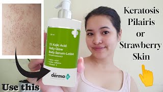 Best Lotion for KERATOSIS PILAIRIS or STRAWBERRY SKIN  Details in description [upl. by Adahsar]