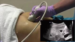 How I do it Ultrasound of the Abdomen [upl. by Si]