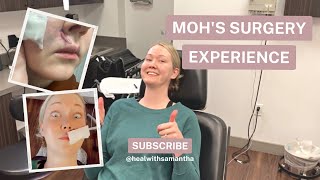 My surprising journey from diagnosis to Mohs surgery [upl. by Dion]