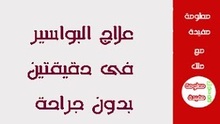 علاج البواسير خلال دقيقتين فقط  بدون جراحة،علاج البواسير الداخلية والخارجية مجربة وفعالة مع ملك [upl. by Azmuh]