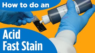 How to do an AcidFast Stain  Instructions for the labprocedure [upl. by Ardnaz]