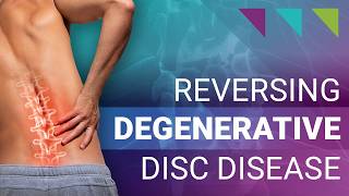 Reversing Degenerative Disc Disease [upl. by Gish]