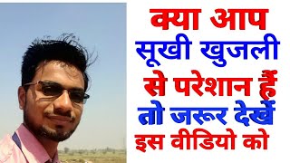 सूखी खुजली को कैसे दूर करें Dry itching treatment  Sukhi khujli [upl. by Eniac]