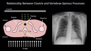 How to Interpret a Chest XRay Lesson 3  Assessing Technical Quality [upl. by Consuela]