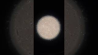 Sperm under a microscope [upl. by Francesco922]