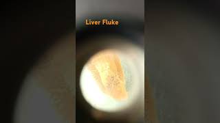 Liver flukeplatyhelminthesFlatwormsharda education world [upl. by Florine39]