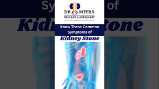 Kidney Stones Symptoms Urologist Andrologist KidneyStones KolkataHealth BestUrologistInKolkata [upl. by Oigres900]