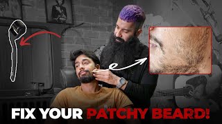 How To Fix Patchy Beard  Patchy Beard Hacks  Beard Growth  Grooming Masterclass EP 2 [upl. by Krys]