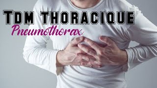 TDM THORACIQUE  Pneumothorax de petite à moyenne abondance [upl. by Ballou]