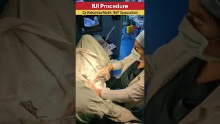 IUI Procedure  intrauterine insemination procedure  by Dr Rakshita Malik ivfcenter iuitreatment [upl. by Schenck149]