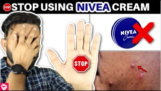 NIVEA CREAM REVIEW  STOP USING THIS⛔  QUALITYMANTRA [upl. by Harmon716]