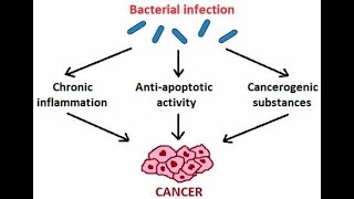 Microbial Carcinogenesis Oncogenic DNA viruses and Oncogenic RNA viruses [upl. by Gaddi]