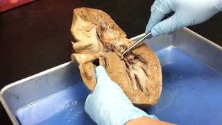 Pig heart Anatomy  Lab Video [upl. by Ennayllek391]