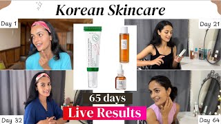 I tried KOREAN SKINCARE products for dark spots amp PIGMENTATION 🎀 65 days live results  Honest [upl. by Notsew]