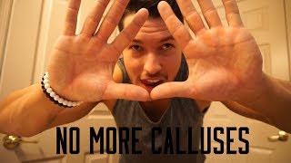 How To Get Rid Of Calluses [upl. by Husch]