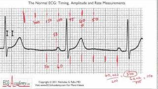 Determining Rate 63  ECG  EKG Interpretation  BASIC [upl. by Ttenna88]