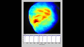 Optical Mapping for Cardiac Electrophsyiology  Mouse Myocytes [upl. by Stahl611]