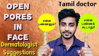 Open pores  Large pores in face  என்ன பண்ணலாம் Dermatologist suggestions Dr Thamizhinian [upl. by Rinum]