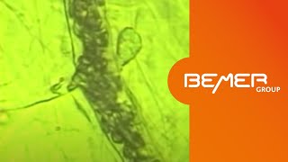 The BEMER Effect  microscopic demonstration of the effect on microcirculation  EN [upl. by Ecertak]