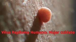 VIRUS PAPILOMA HUMANO CUÍDATE MUJER [upl. by Kcirdneh]