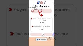 SerodiagnosisGiardia lamblia parasitology microbiology pathology diagnosis neetpg neet [upl. by Aicelef]