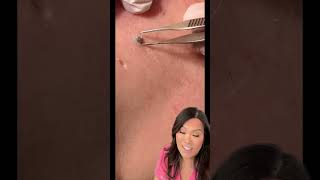 Some great blackheads and DPOWs on the back [upl. by Stormy501]