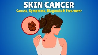 Skin Cancer – Causes Signs and Symptoms Diagnosis amp Treatment [upl. by Leonteen]