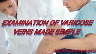 Examination Of Varicose VeinsTrendelenburg TestModified perthes Test and Feegan Test Made Simple [upl. by Heid]