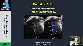 Pediatric Echo Part 4 Apical window [upl. by Hudnut]